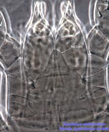  Fig. 10.  Spadiseius spathiphyllae  paratype female tectum. 
