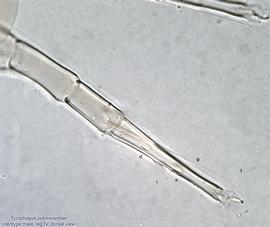  Fig. 12.  Tyrophagus putrescentiae  neotype male leg IV, dorsal view. 