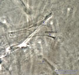  Fig. 16.  Spadiseius spathiphyllae  paratype female spermatheca, optical section of hysterosoma in region of insertion of leg coxae III-IV. 