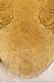  Fig. 4.  Xylocolaelaps  sp. (ex  Xylocopa nigrita ) female genito-anal region. 