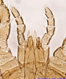  Fig. 6.  Pneumolaelaps  sp. (ex  Bombus crotchii;  CA) female gnathosoma. 