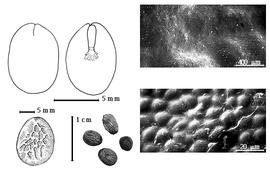  Seed, cotyledon, embryo, and testa:  A. laeta  (G. Bentham) R.C. Barneby amp; J.W. Grimes - top left cotyledons concealing radicle (L) and embryonic axis (R), bottom left seed topography, bottom left center seeds, testa SEMs.
