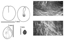  Seed, cotyledon, embryo, and testa:  A. racemiflora  (Donnell Smith) R.C. Barneby amp; J.W. Grimes - top left cotyledon concealing radicle (L) and embryonic axis (R), bottom left seed topography, bottom left center seed, and testa SEMs.
