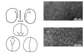  Cotyledon, embryo, and testa:  P. sativum  C. Linnaeus subsp.  elatius  (C. von Steven ex F.A.M. von Bieberstein) P.F.A. Ascherson amp; K.O.R.P.P. Graebner - embryo, cotyledons, and testa SEMs.
