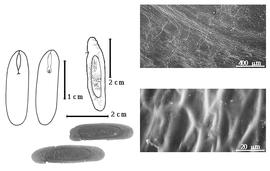  Seed, cotyledon, embryo, and testa:  P. psilostachya  (G. Bentham) G.P. Lewis amp; M.P. Lima - left cotyledon not concealing radicle (L) and embryonic axis (R), left top center seed topography, left bottom center seeds, testa SEMs.
