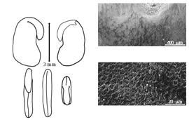  Cotyledon, embryo, and testa:  S. securidaca  (C. Linnaeus) A. von Degen amp; I. Doerfler - embryo, cotyledons, and testa SEMs.
