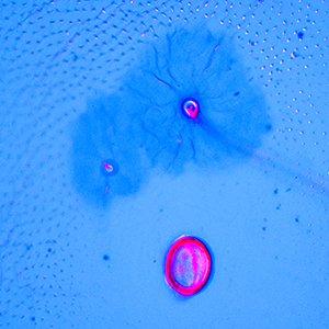 SD2 seta on A2 in <em>C. pomonella</em>