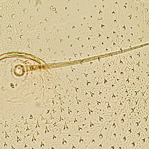 Cuticle texture in <em>H. assulta</em> (low power)