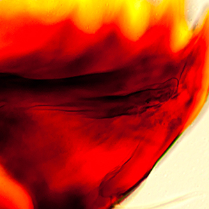 Inner tooth on mandible of <em>D. considerata</em>