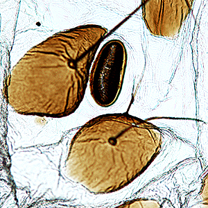 SD2 seta position on A8 in <em>D. magnifactella</em>
