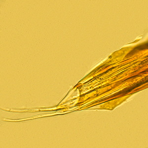 Apical setae on spinneret of <em>D. considerata</em>