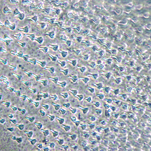 Cuticle texture in <em>Amorbia</em>