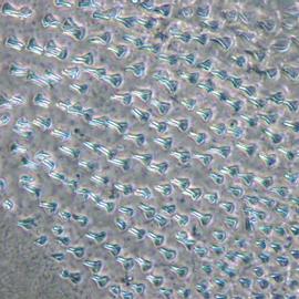 Fig. 5: Body spinules