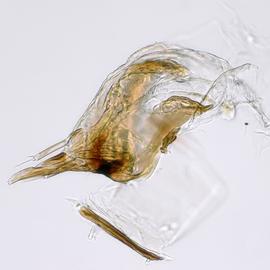 Fig. 11: Hypo. complex