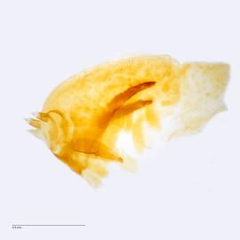 Fig. 9: Hypo. complex