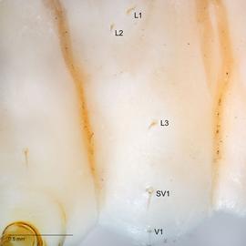 Fig. 5: SV group on A1