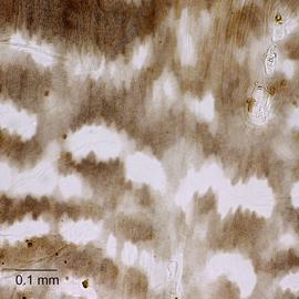 Fig. 9: Smooth cuticle