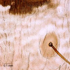 Fig. 4: Cuticle texture