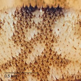 Fig. 7: Spiny cuticle
