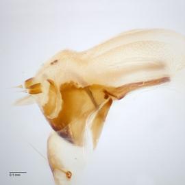 Fig. 11: Hypo. complex