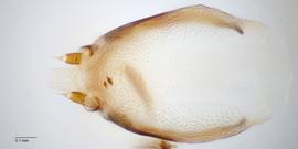 Fig. 13: Hypopharyngeal complex, dorsal view