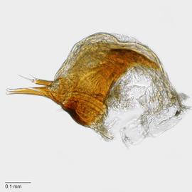 Fig. 11: Hypo. complex
