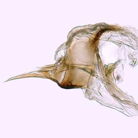 Fig. 7: Hypo. complex