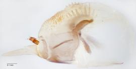 Fig. 9: Hypopharyngeal complex, lateral view