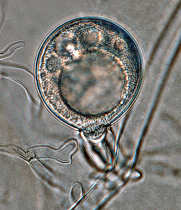 Phytophthora cinnamomi selected specimen P6490 sexual phase: young oogonium with amphigynous antheridium; photo by Gloria Abad, USDA-APHIS-PPQ.