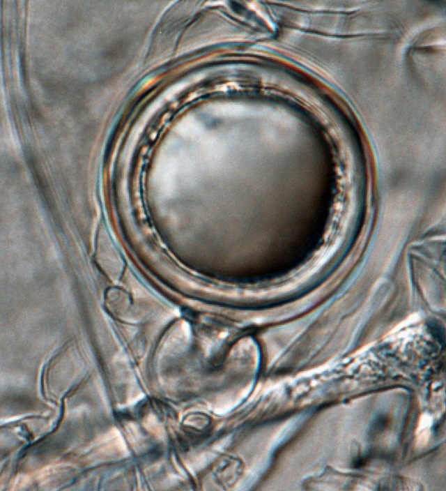 Phytophthora cinnamomi nbsp;sexual phase: young oogonium with amphigynous antheridium; photo by Gloria Abad, USDA-APHIS-PPQ.