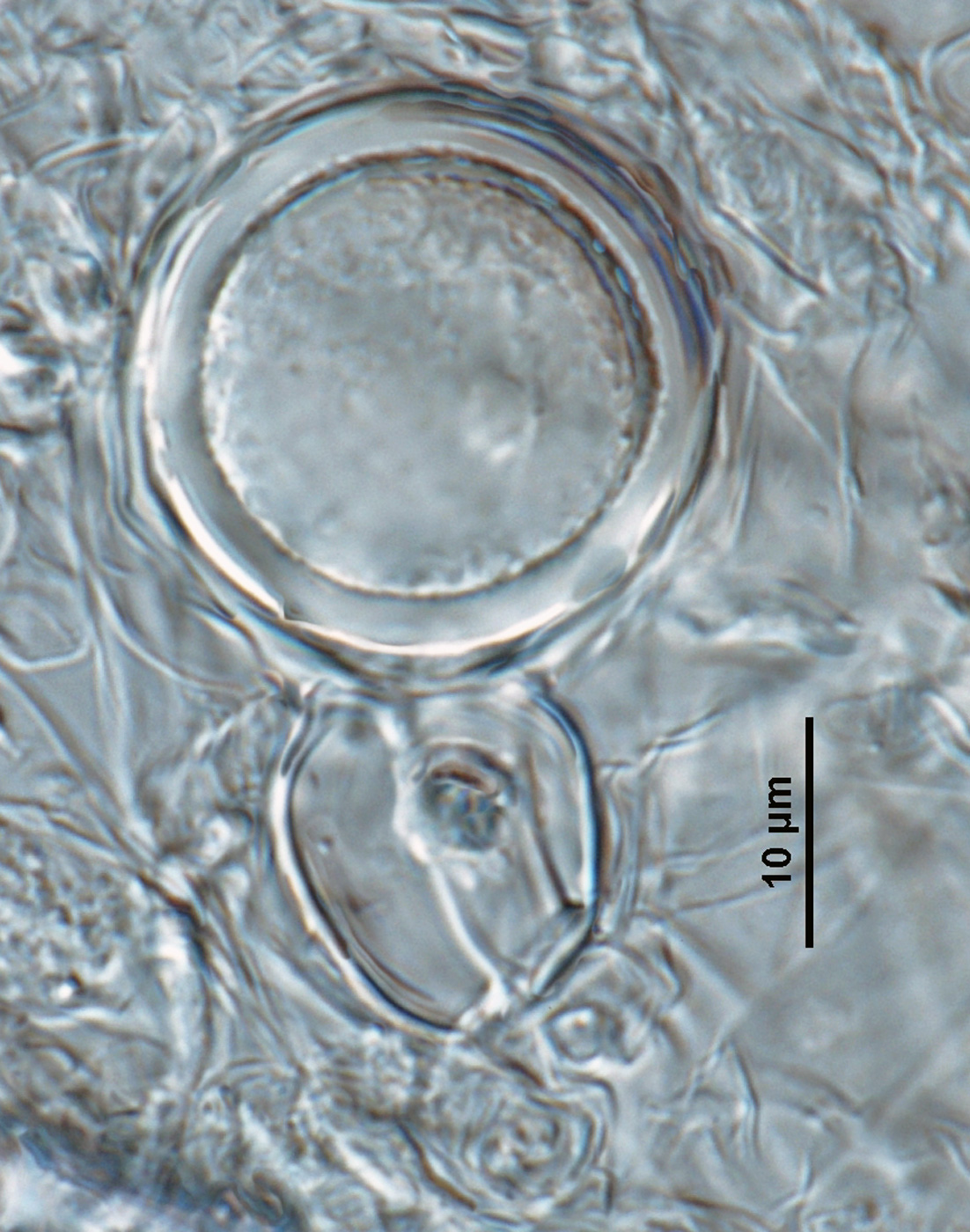 Phytophthora amaranthi nbsp;(ex-type CPHST BL 174) homothallic sexual phase: smooth-walled oogoniumnbsp;with amphigynous antheridiumnbsp;and aplerotic oospore; photonbsp;by Gloria Abad, USDA-APHIS-PPQ.
