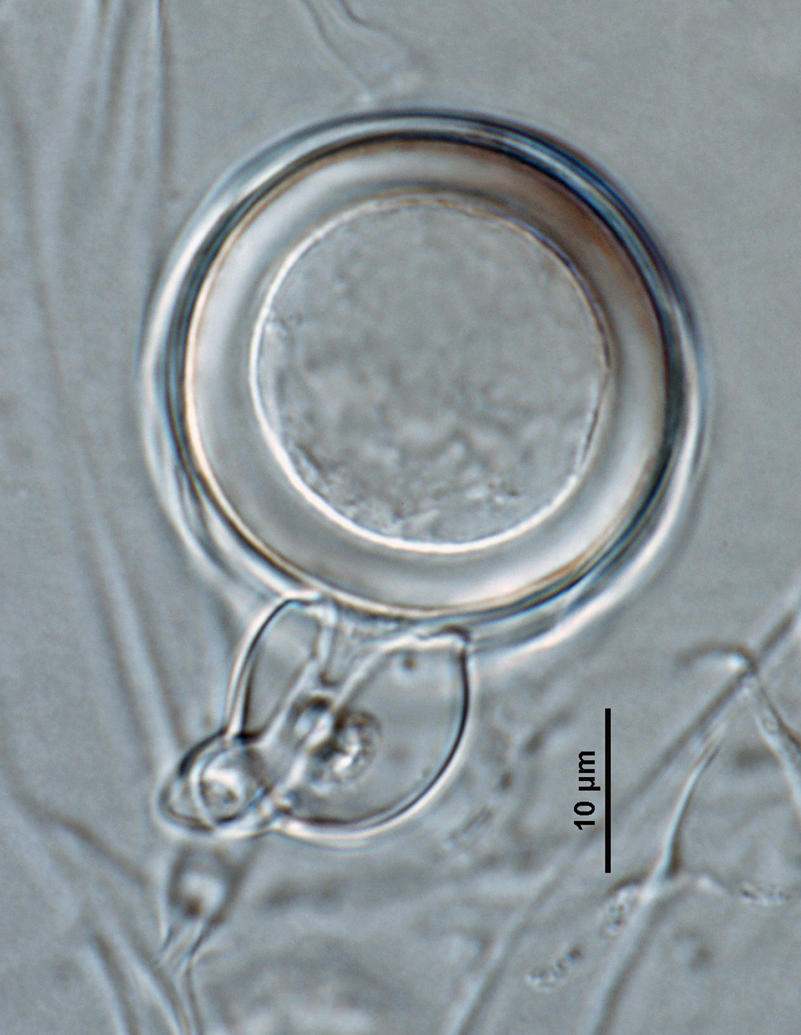 Phytophthora amaranthi nbsp;(ex-type CPHST BL 174) homothallic sexual phase:nbsp;smooth-walled oogoniumnbsp;with amphigynous antheridiumnbsp;and aplerotic oospore; photonbsp;by Gloria Abad, USDA-APHIS-PPQ.