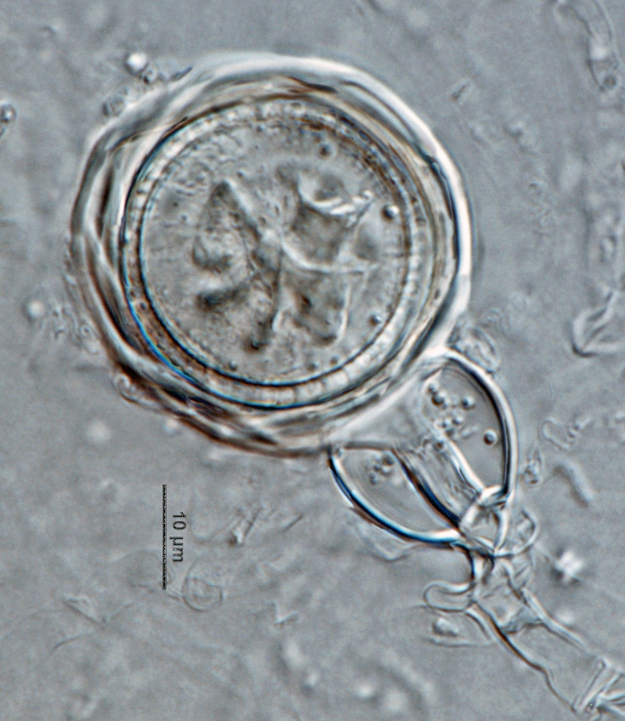Phytophthora amaranthi nbsp;(ex-type CPHST BL 174) homothallic sexual phase:nbsp;smooth-walled oogoniumnbsp;with amphigynous antheridiumnbsp;and aplerotic oospore; photonbsp;by Gloria Abad, USDA-APHIS-PPQ.