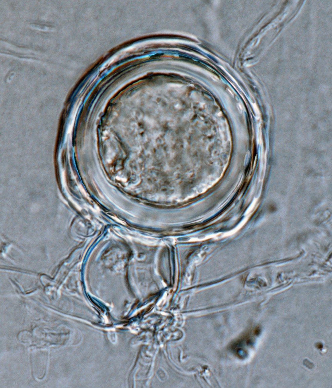 Phytophthora amaranthi nbsp;(ex-type CPHST BL 174) homothallic sexual phase:nbsp;smooth-walled oogoniumnbsp;with amphigynous antheridiumnbsp;and aplerotic oospore; photonbsp;by Gloria Abad, USDA-APHIS-PPQ.