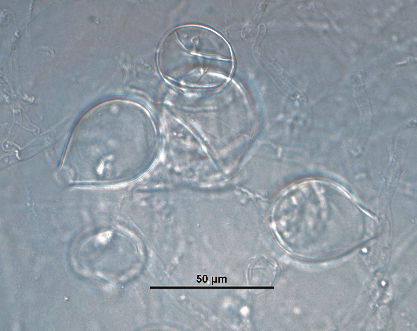Phytophthora amaranthinbsp; (ex-type CPHST BL 174) asexual phase:nbsp;papillate and semipapillate sporangia; photos by Gloria Abad, USDA-APHIS-PPQ.
