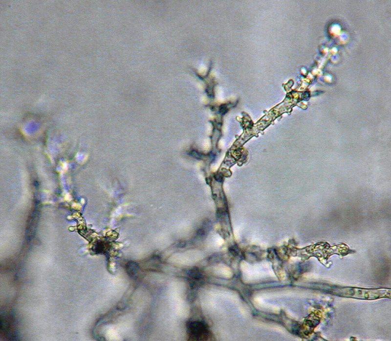 Phytophthora cinnamomi nbsp;selected specimen P6490 asexual phase:nbsp;typical coralloid mycelia; photonbsp;by Gloria Abad, USDA-APHIS-PPQ.