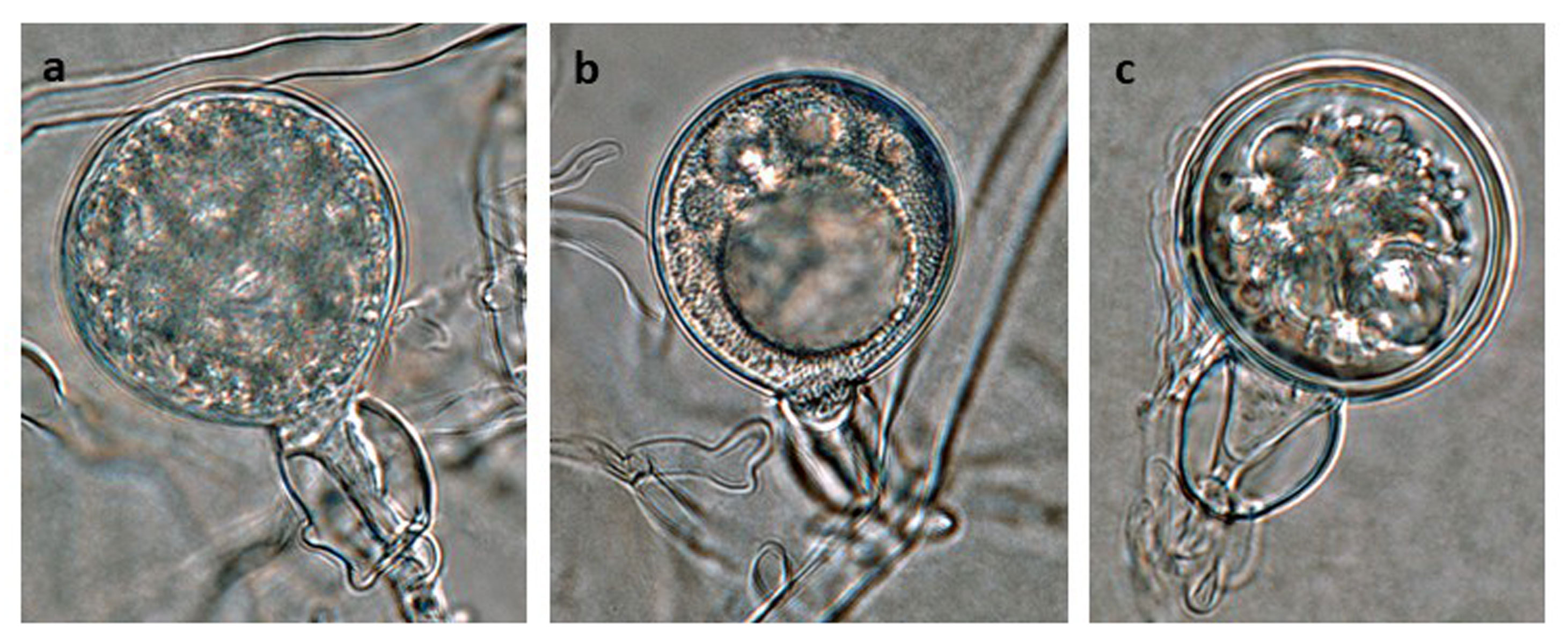 Phytophthora cinnamomi selected specimen P6490 sexual phase (a-c): (a, b) young oogonia with amphigynous antheridia, (c) abortive oogonium; photos by Gloria Abad, USDA-APHIS-PPQ.