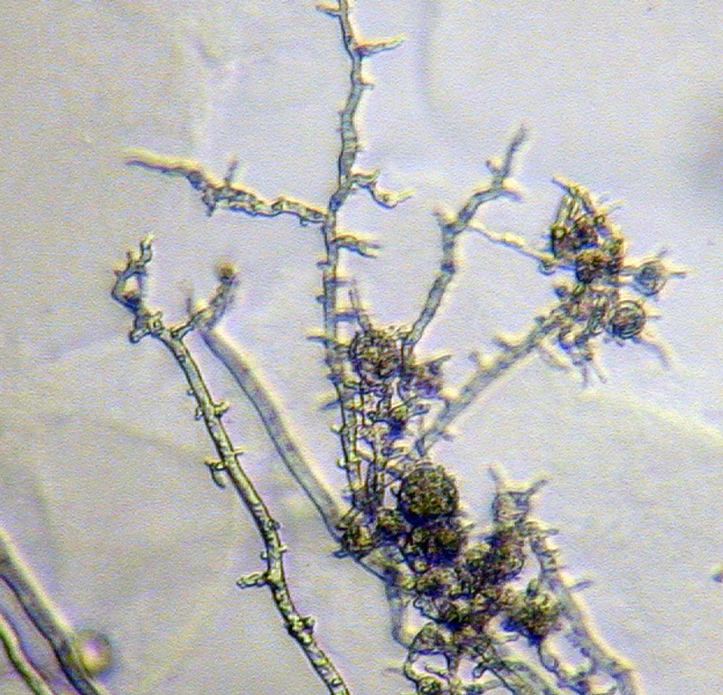 Phytophthora cinnamomi nbsp;asexual phase: typical coralloid mycelia and botryosenbsp; hyphal swellings; photonbsp;by Gloria Abad, USDA-APHIS-PPQ.