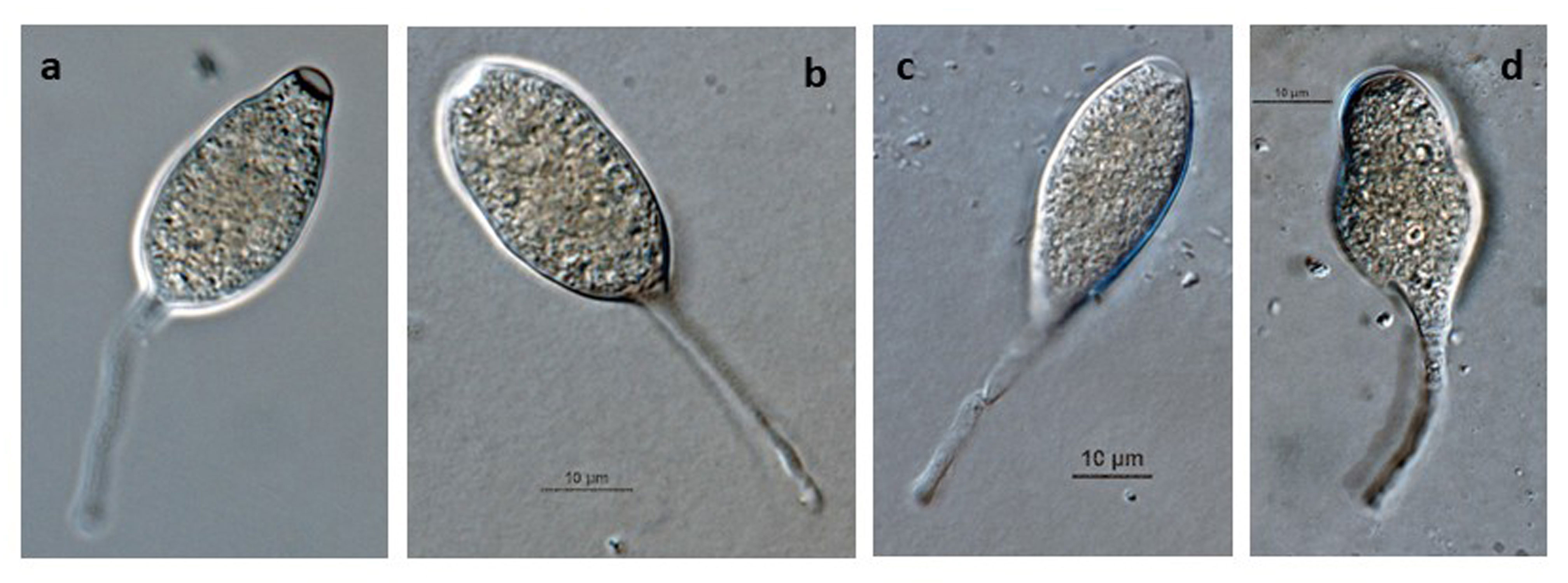 Phytophthora hibernalis nbsp;(CPHST BL 41G) asexual phase: (andash;d) semipapillate sporangia, caducous with medium to long pedicels; photos by Gloria Abad, USDA-APHIS-PPQ.