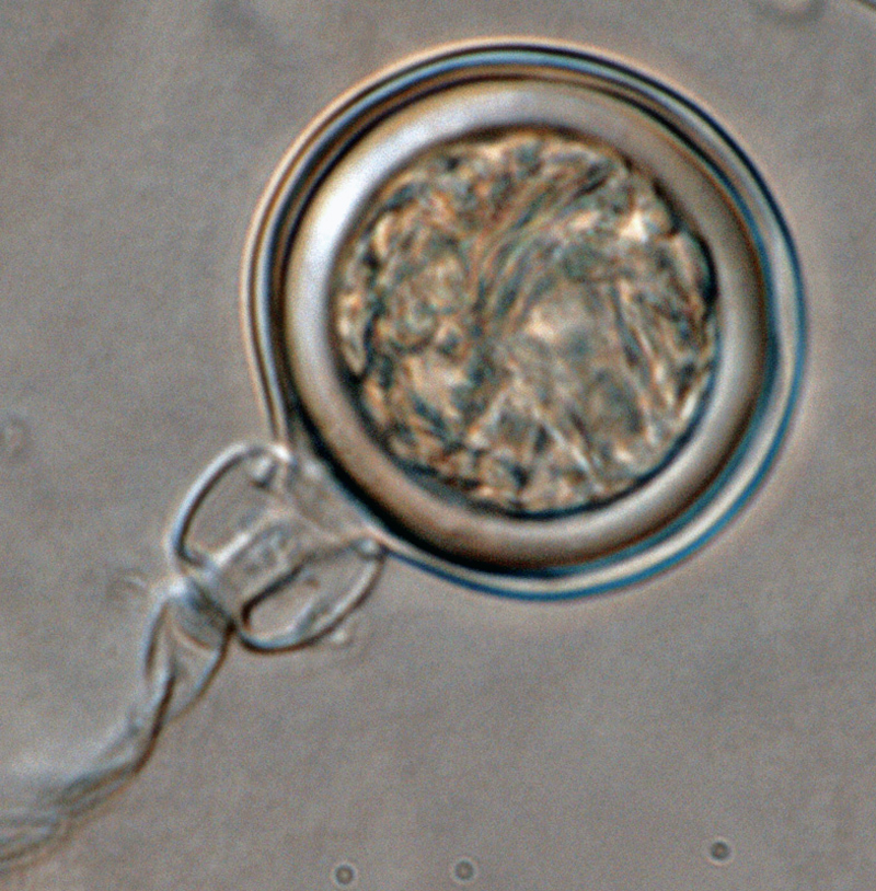 Phytophthora kernoviae (selected specimen P10956)nbsp;sexual phase:nbsp;smooth-walled oogonium with amphigynous antheridium; photo by Gloria Abad, USDA-APHIS-PPQ.