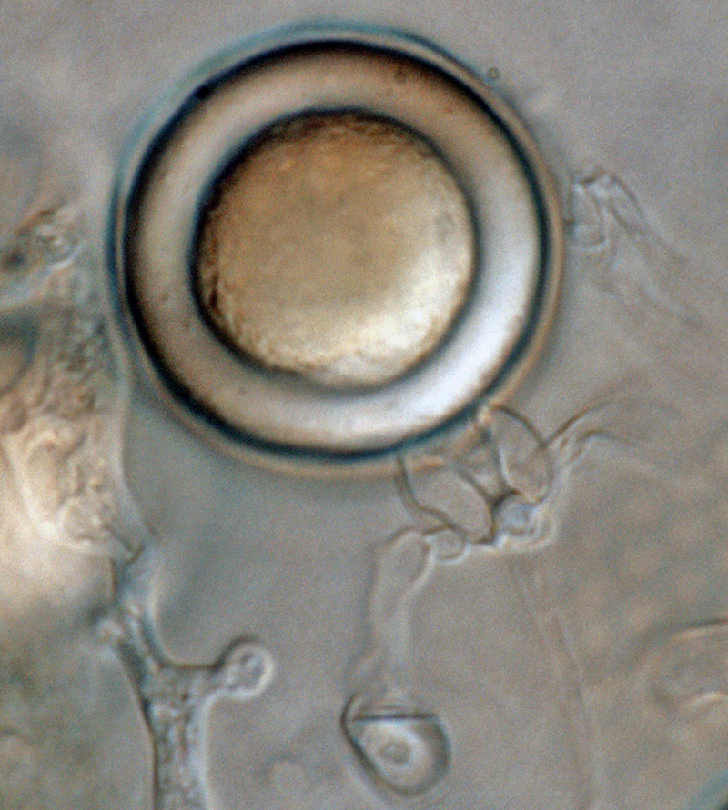 Phytophthora kernoviae (selected specimen P10956)nbsp;sexual phase: medium thick-walled plerotic oospore smooth-walled oogonium and amphigynous antheridium; photo by Gloria Abad, USDA-APHIS-PPQ.