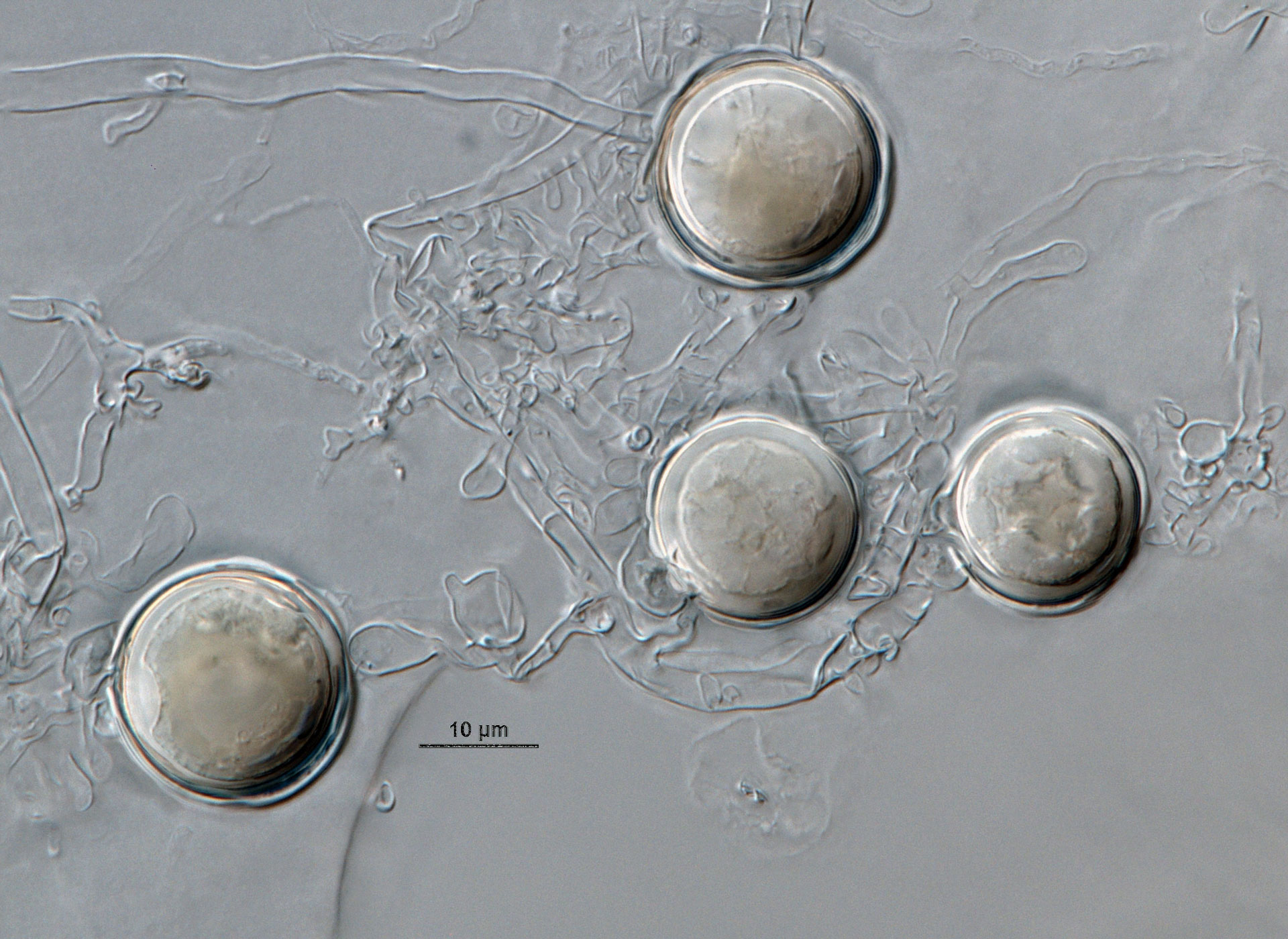Phytophthora acerina nbsp;(ex-type CPHST BL 114) sexual phase formed on hemp seed agar. Smooth-walled oogonianbsp;with paragynous antheridianbsp;and plerotic oospores. Photonbsp;by G. Abad, USDA-APHIS-PPQ.
