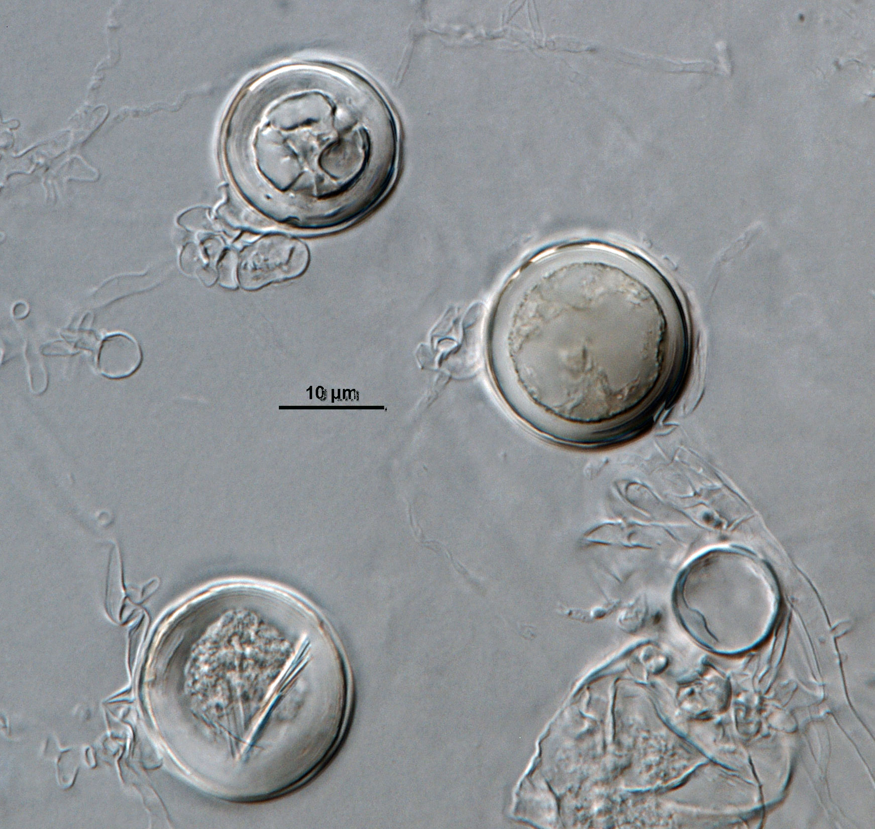 Phytophthora acerina nbsp;(ex-type CPHST BL 114) sexual phase formed on hemp seed agar. Smooth-walled oogonianbsp;with paragynous antheridianbsp;and plerotic oospores. Photonbsp;by G. Abad, USDA-APHIS-PPQ.