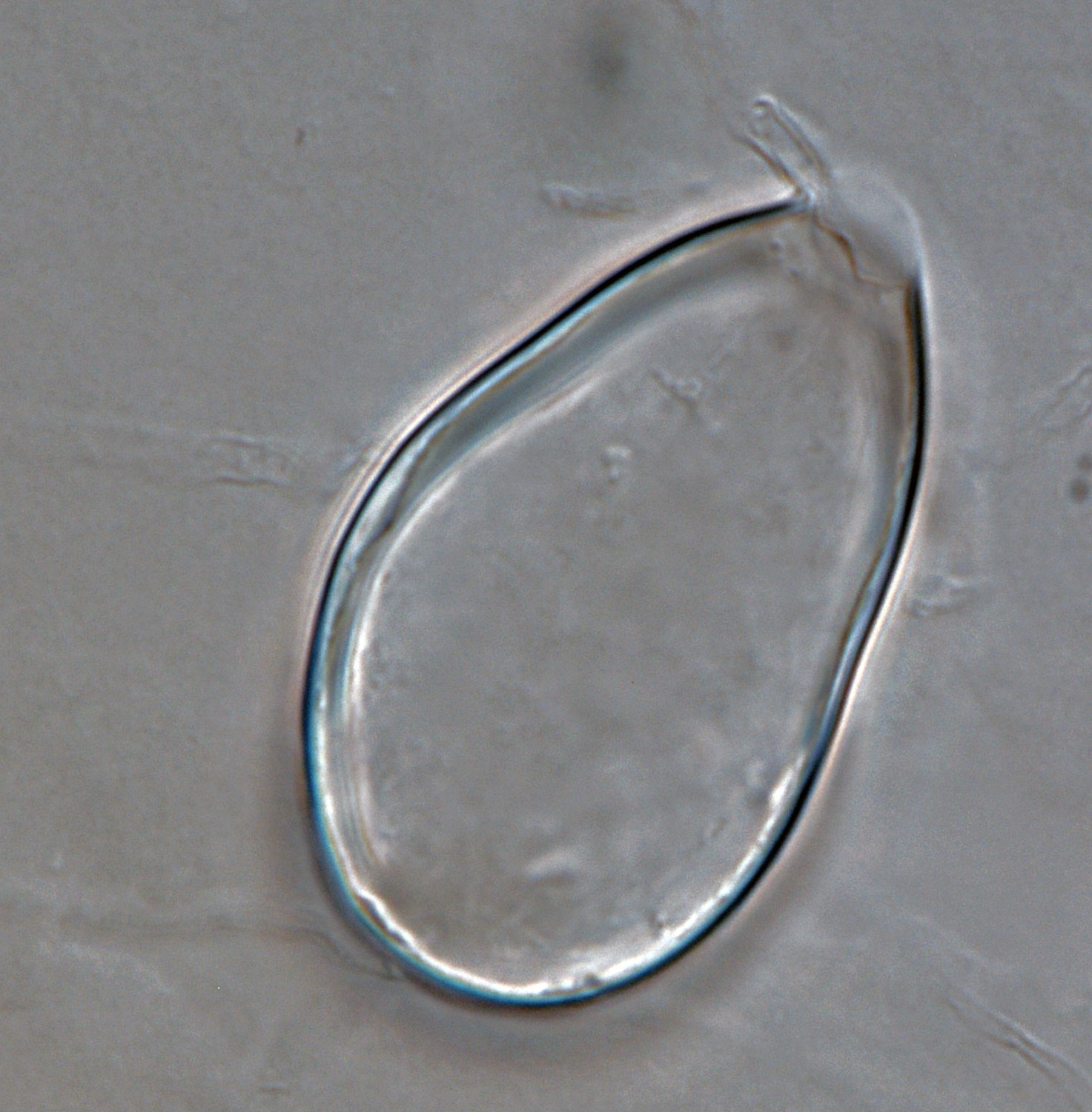 Phytophthora acerina nbsp;(CPHST BL 114, ex-type) asexual phase;nbsp;semi-papillatenbsp;persistent sporangium. Photonbsp;by G. Abad, USDA-APHIS-PPQ.