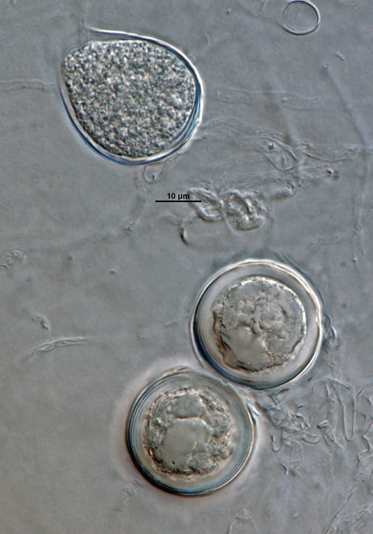 Phytophthora acerina nbsp;(ex-type CPHST BL 114) asexual and sexual phase. Smooth-walled oogonianbsp;and semi-papillatenbsp;persistent sporangium. Photonbsp;by G. Abad, USDA-APHIS-PPQ.