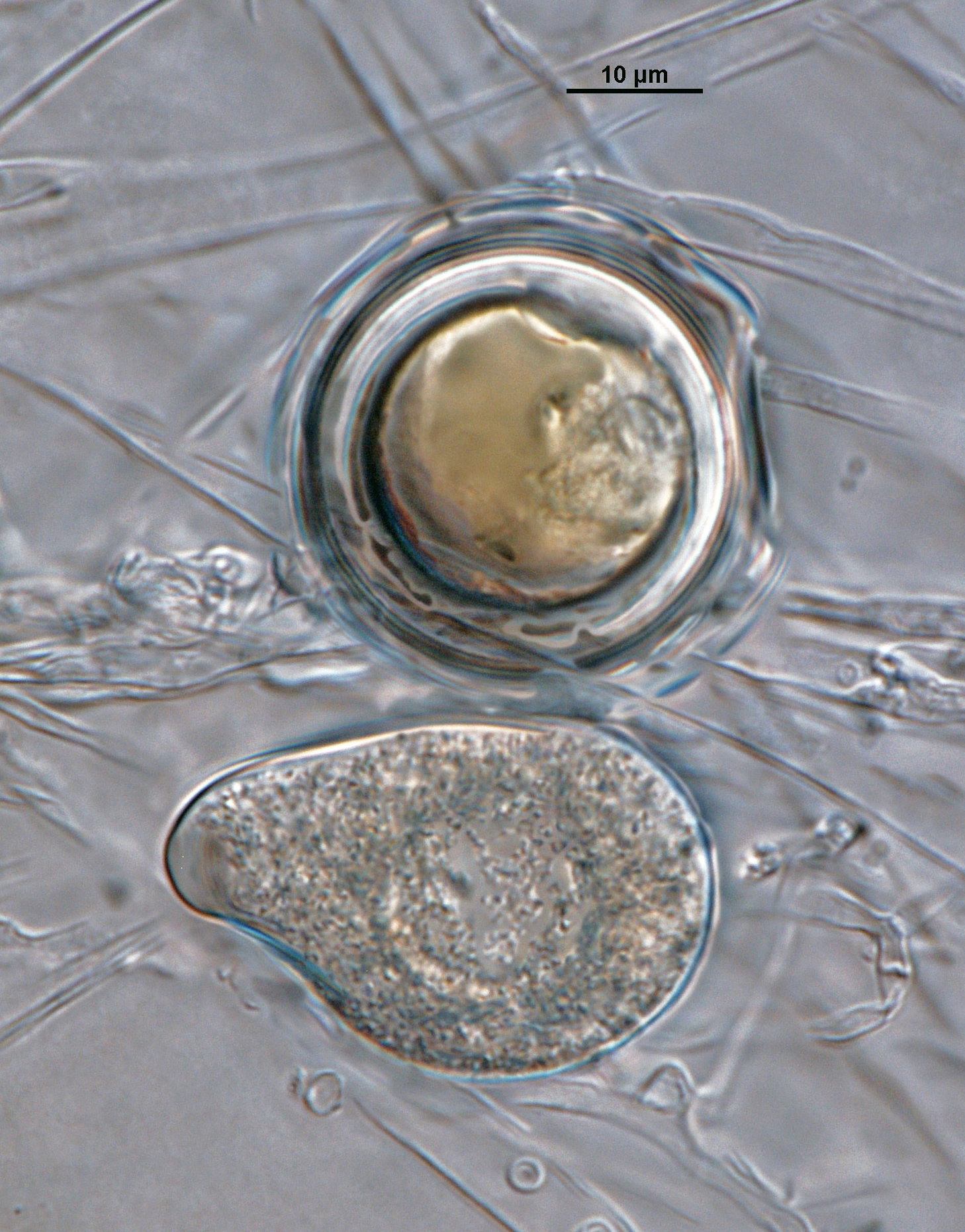 Phytophthora acerina nbsp;(ex-type CPHST BL 114) asexual and sexual phase. Smooth-walled oogonium and semi-papillatenbsp;persistent sporangium. Photonbsp;by G. Abad, USDA-APHIS-PPQ.