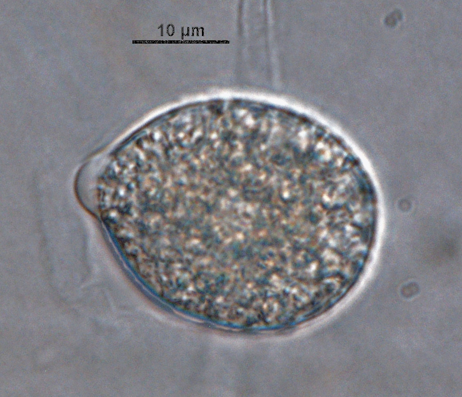 Phytophthora acerina nbsp;(CPHST BL 114, ex-type) asexual phase;nbsp;semi-papillatenbsp;persistent sporangium. Photonbsp;by G. Abad, USDA-APHIS-PPQ.