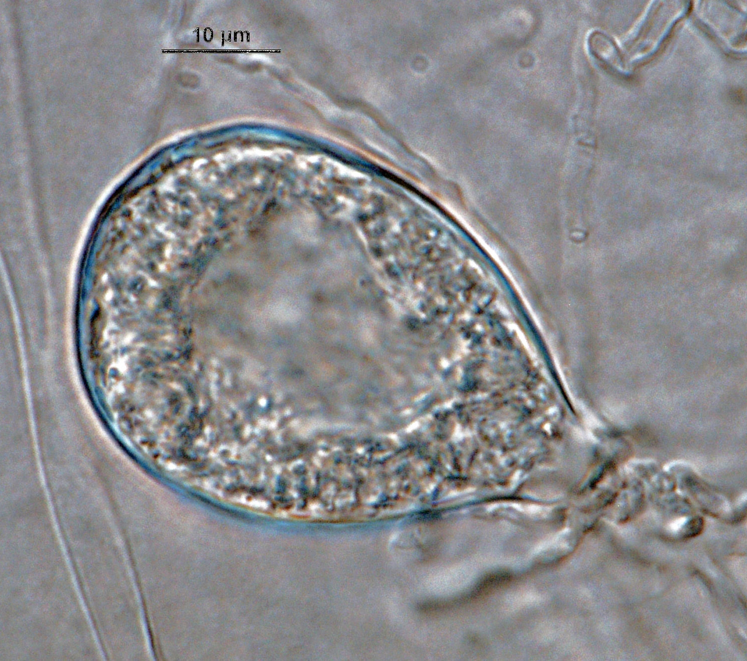 Phytophthora acerina nbsp;(CPHST BL 114, ex-type) asexual phase;nbsp;semi-papillatenbsp;persistent sporangium. Photonbsp;by G. Abad, USDA-APHIS-PPQ.