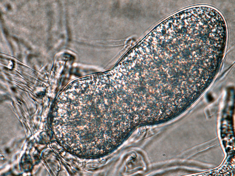 Phytophthora cinnamomi nbsp;selected specimen P6490 asexual phase: nonpapillate sporangium; photo by Gloria Abad, USDA-APHIS-PPQ.