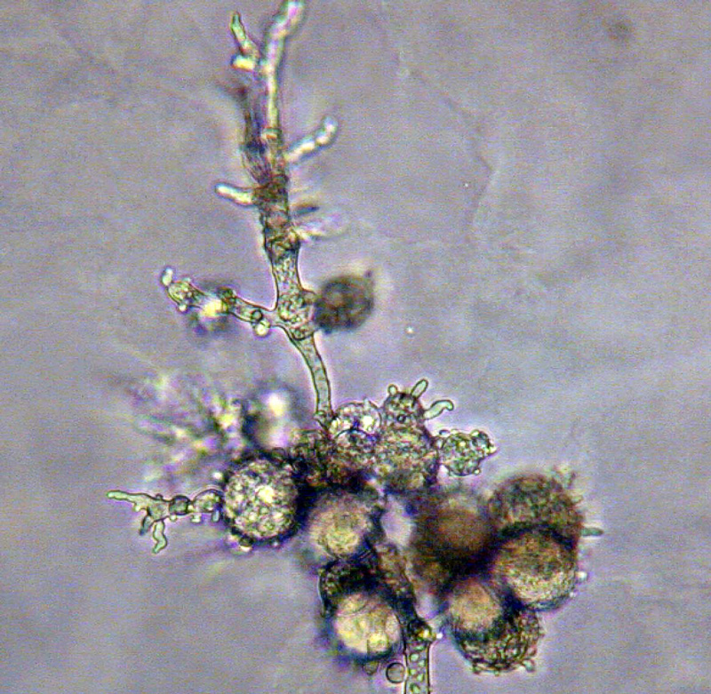 Phytophthora cinnamomi nbsp;asexual phase:nbsp;typical coralloid mycelia and botryosenbsp;hyphalnbsp;swellings; photonbsp;by Gloria Abad, USDA-APHIS-PPQ.